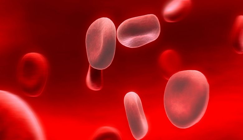 علائم کم خونی شدید در بانوان + درمان کم خونی